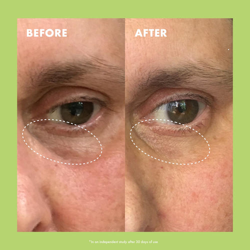 Niacinamide & Caffeine Eye Bright Cream 