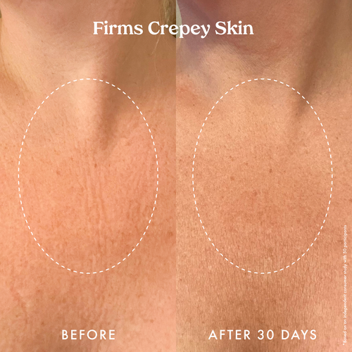 Ultra Renewal Retinol Body Cream 