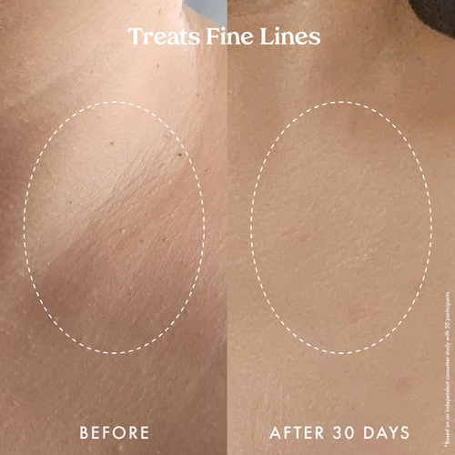 Ultra Renewal Retinol Body Cream 
