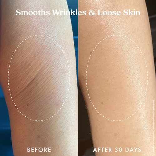 Ultra Renewal Retinol Body Cream 
