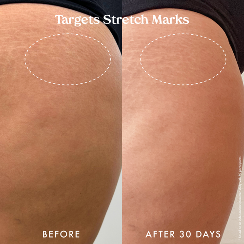 Ultra Renewal Retinol Body Cream 