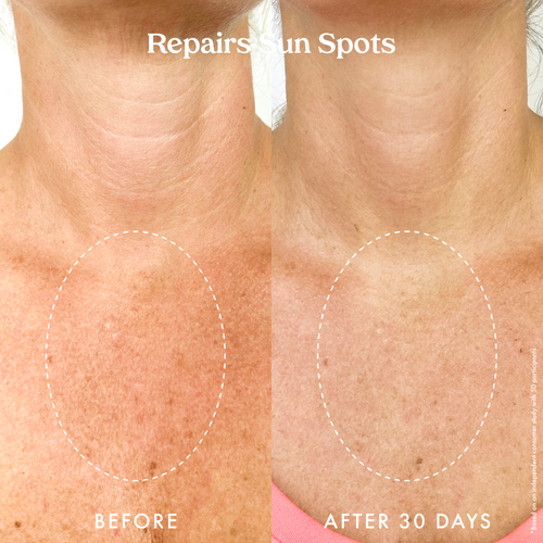 Ultra Renewal Retinol Body Cream 