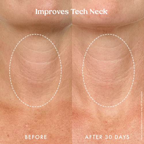 Ultra Renewal Retinol Body Cream 