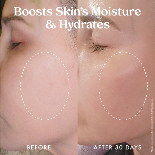 Star Bright Vitamin C Moisturizer 