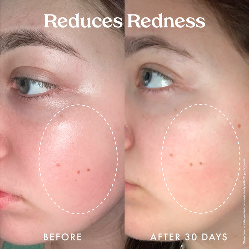 Star Bright Vitamin C Moisturizer 