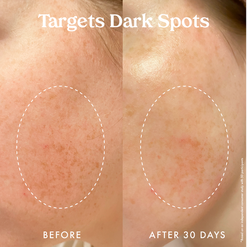 Star Bright Vitamin C Moisturizer 