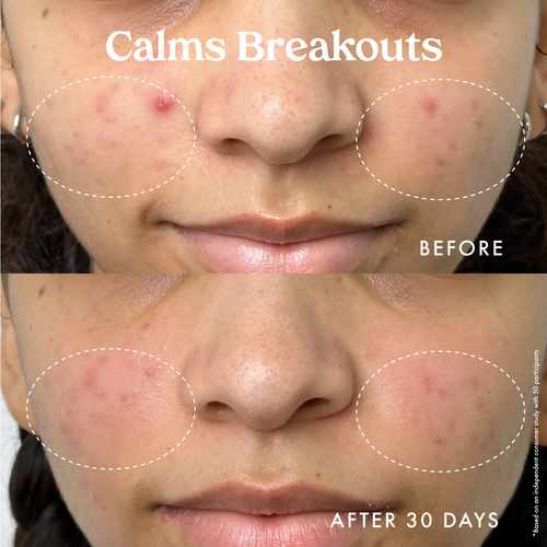 Star Bright Vitamin C Moisturizer 