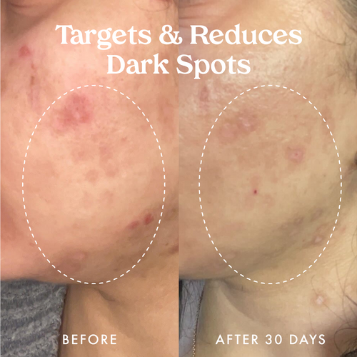 Star Bright Vitamin C Discoloration Correcting Serum 