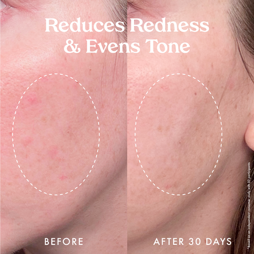 Star Bright Vitamin C Discoloration Correcting Serum 