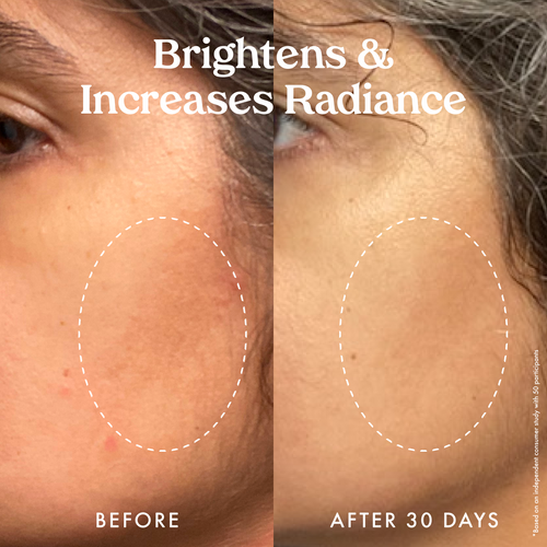 Star Bright Vitamin C Discoloration Correcting Serum 